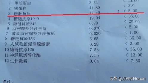 得了癌症cea一定会升高吗,癌症手术后cea缓慢升高