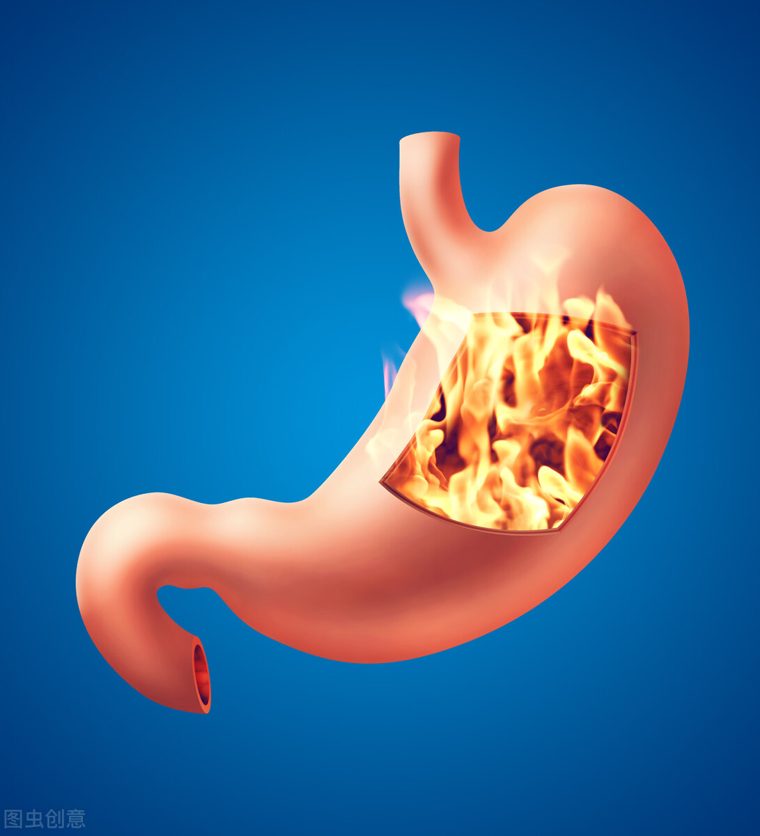 胃烧心要吃什么好,胃烧心是怎么回事饮食吃啥