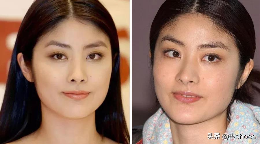 如何改善自己的脸型提升颜值,脸型真的很重要它决定你的颜值