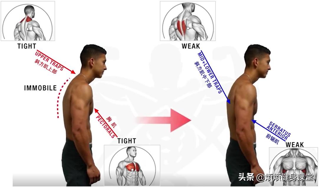 帕梅拉10分钟改善圆肩驼背,改善圆肩驼背的最有效动作