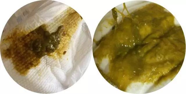 婴儿配方奶粉知识问答集锦,婴幼儿配方奶粉出问题