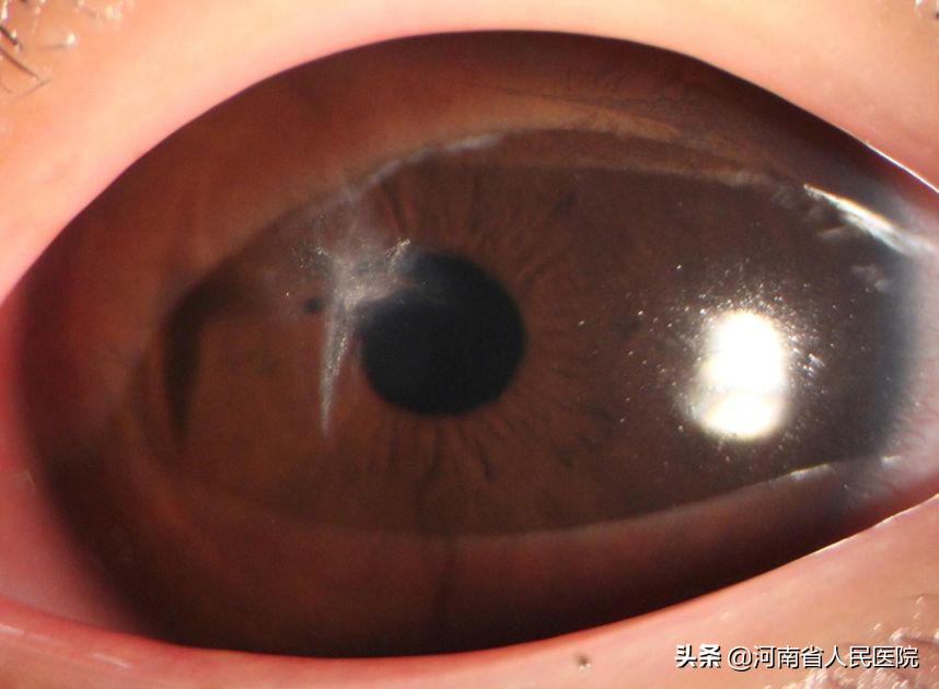 吃药杀病毒儿童,儿童杀病毒