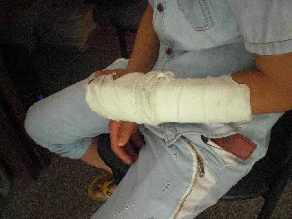 手机放床头充电爆炸起火,小台灯充电发生爆炸