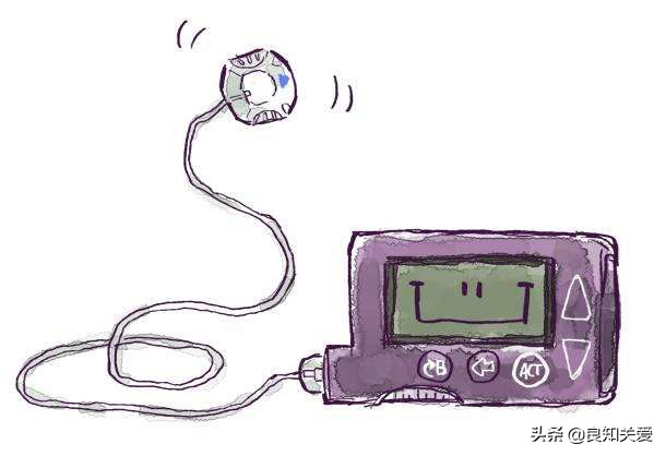 打胰岛素后痒是怎么回事,糖尿病打胰岛素瘙痒怎么处理
