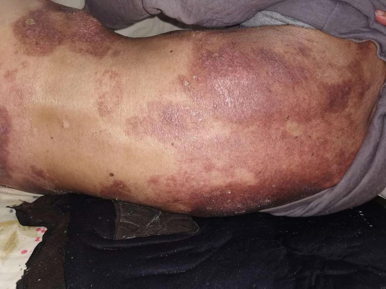 鑰佷汉韬綋琛扮鐨偆婧冪儌,鍗у簥鑰佷汉韬綋鐨偆婧冪儌鐢ㄤ粈涔堣嵂