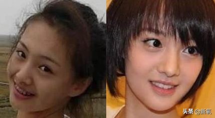 盘点整容后不敢认的女星颜值巅峰,知名女网红被扒整容