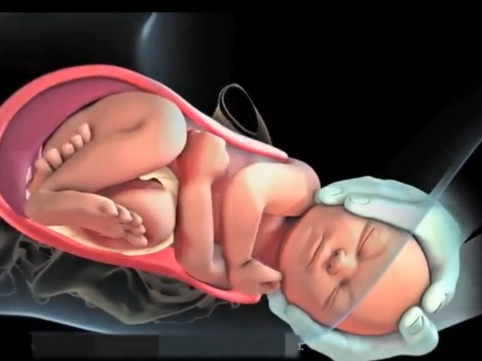 顺产全部过程是什么,顺产的整个过程要经历什么