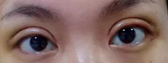 1元脱毛靠谱吗,0元免费脱毛