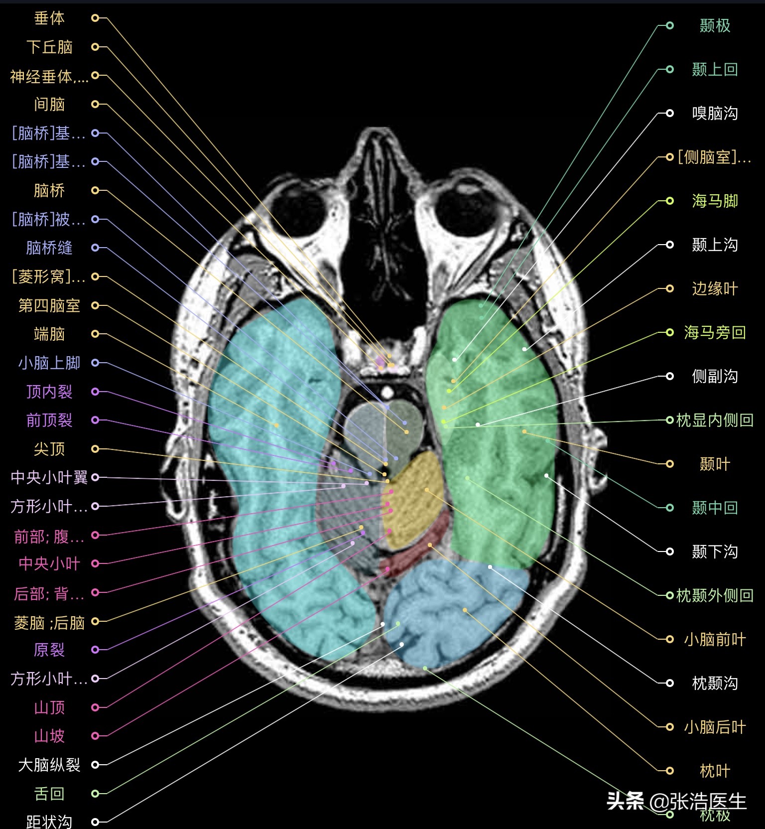 颅脑mri解剖影像检查是什么意思,颅脑mri断层解剖视频课件