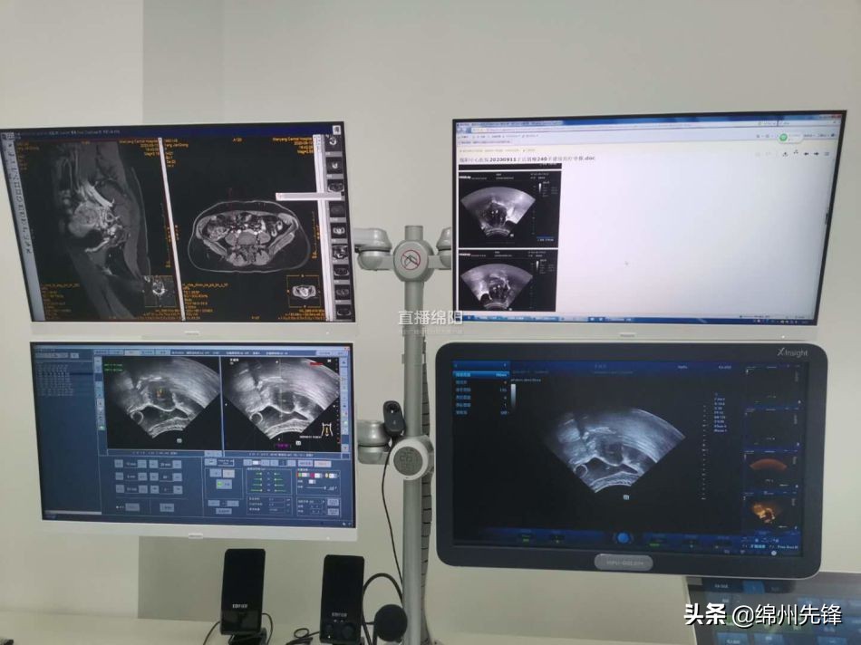 超声波精准治疗癌症,绵阳最有效的黑科技