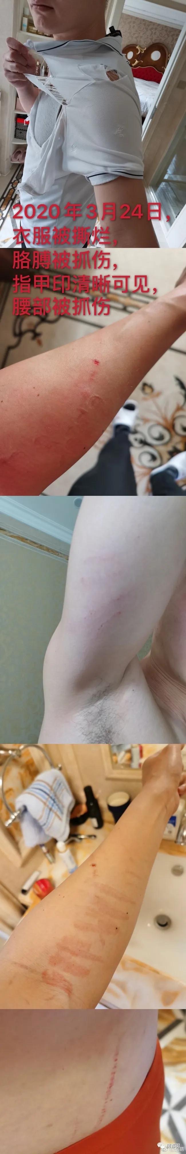 短跑名将张培萌被曝家暴,短跑名将张培萌殴打岳母被行拘