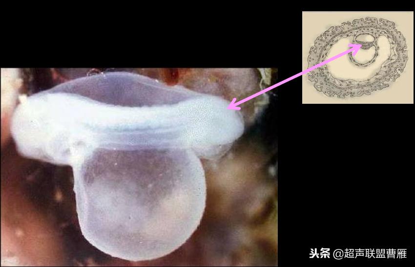 3毫米卵黄囊未见胎芽正常么,40多天的卵黄囊