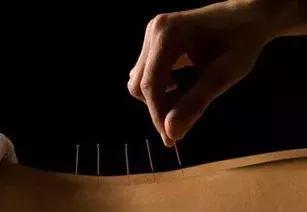 中医针灸穴位歌诀大全快收藏吧,中医针灸穴位歌诀大全收藏吧