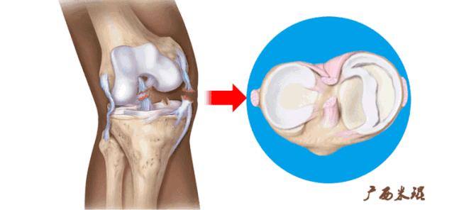 听骨科医生讲的话,听完骨科专家的一段话