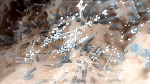 50%痛风患者无法工作和下地干活,在家突然痛风如何紧急减痛