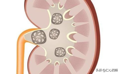 人体结节囊肿肌瘤形成原因有哪些,肌瘤结节囊肿的区别