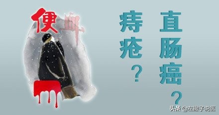 肠癌与肠肿瘤有区别吗,肠癌和痔疮有直接关系吗