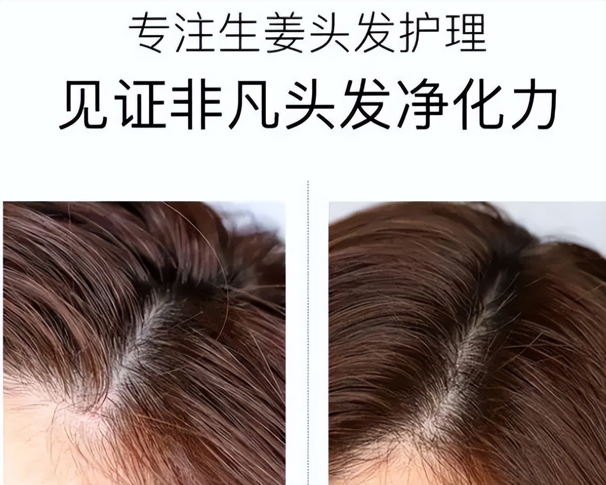 超市里推荐用了不掉发的洗发水,超市洗发水推荐黑榜