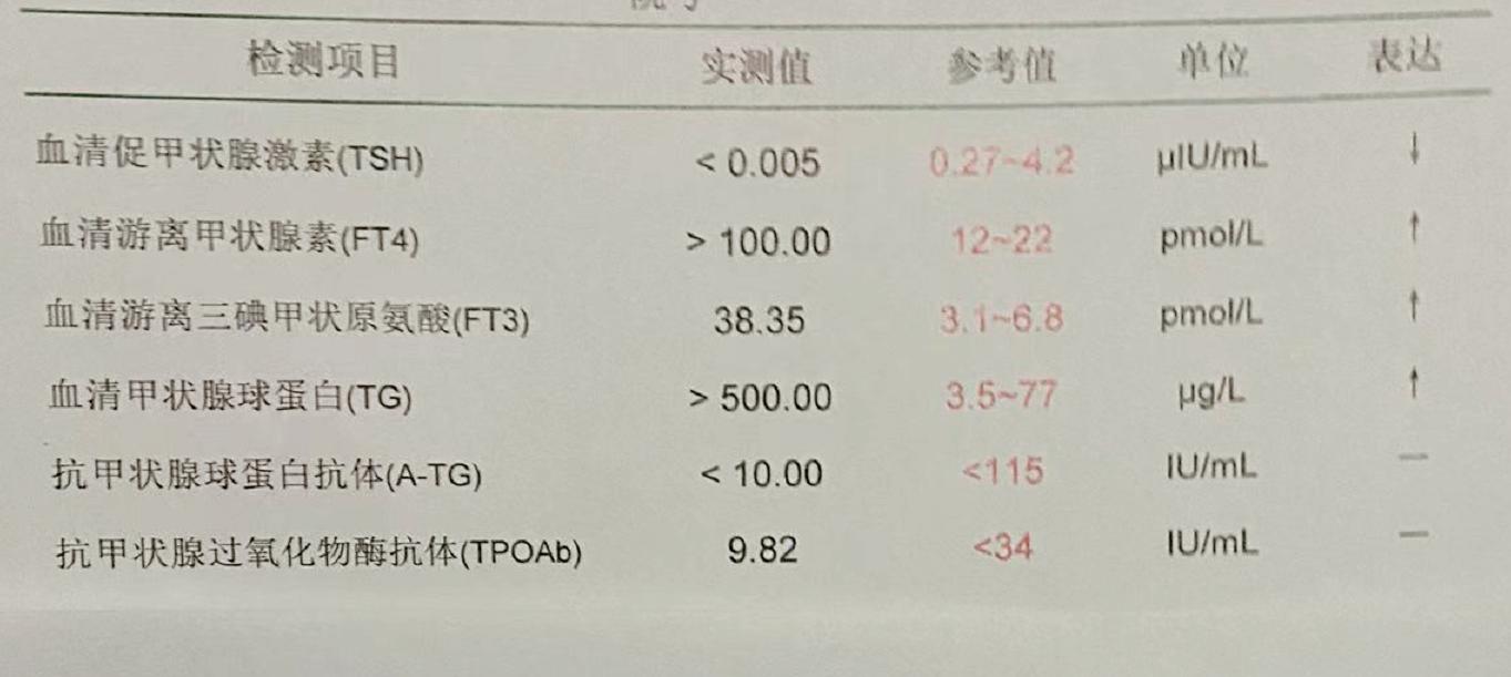 甲状腺指标高是甲亢还是甲减,甲状腺指标过高是甲亢还是甲减