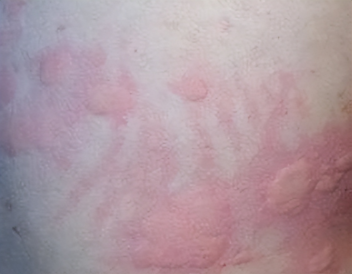 气虚血虚又血瘀吃什么中成药,血燥血虚湿气太重身痒