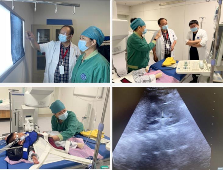 北京大学人民医院保胆取石,儿童结石微创手术