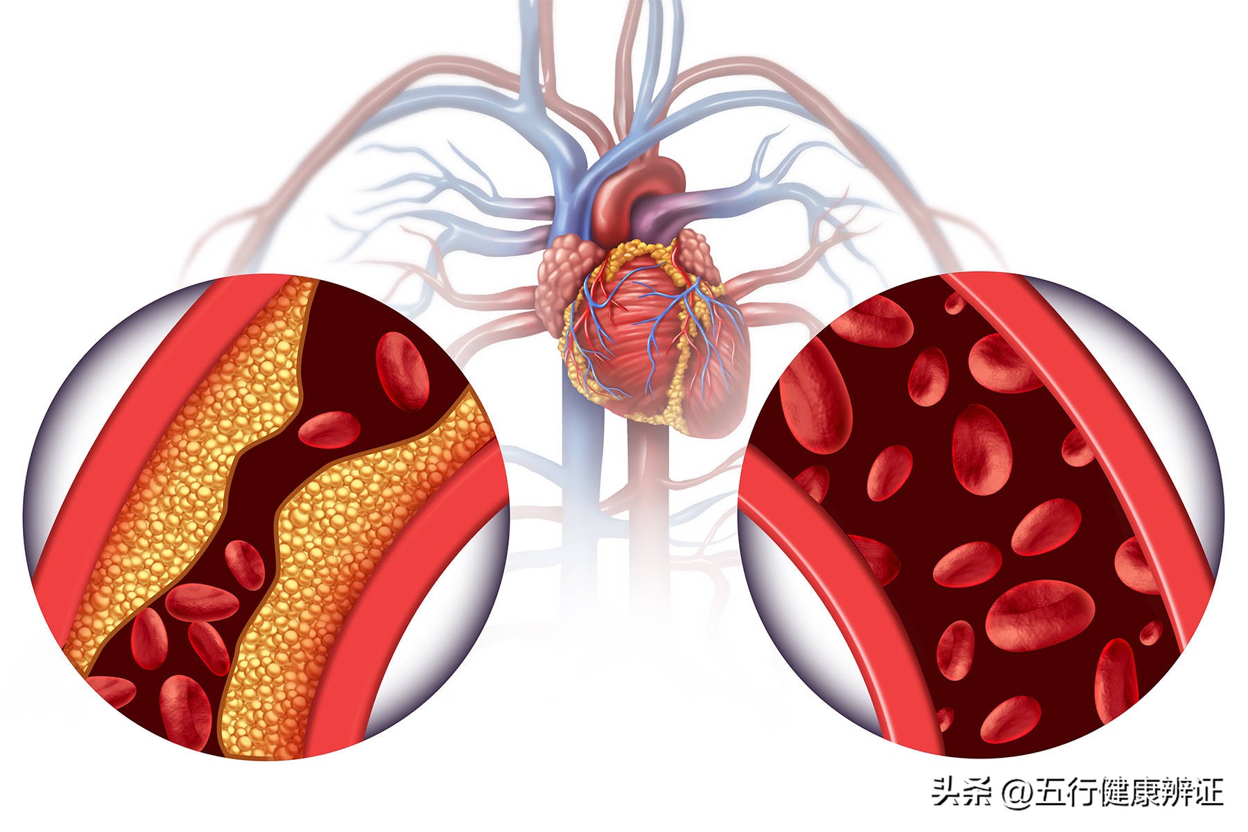 嗜食症在生活中有哪3个症状?要如何改善