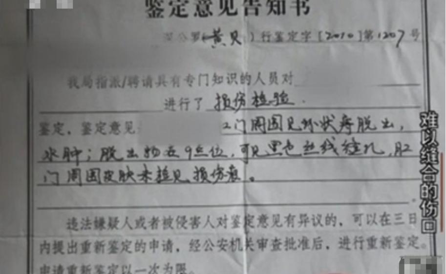 深圳某护士将产妇肛门缝上，只因嫌100元红包少，医院：痔疮结扎