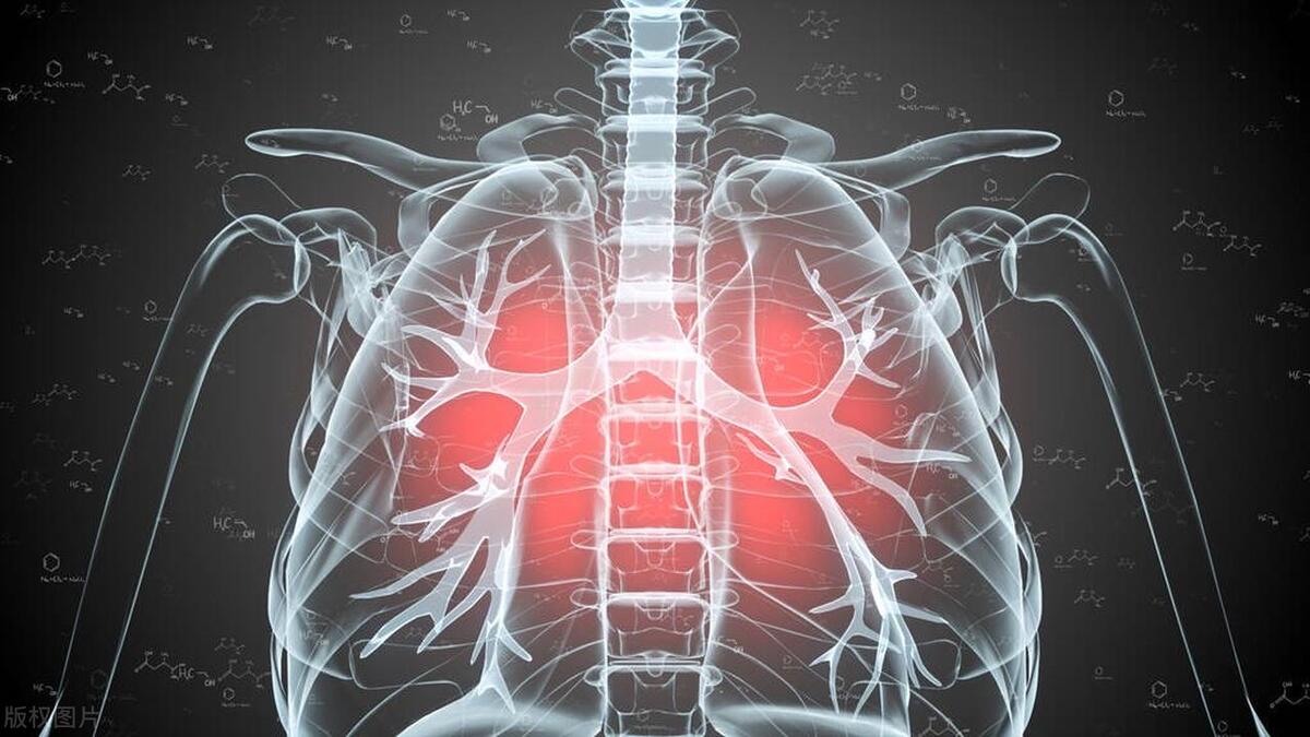 以为是肩周炎一查竟然是肝癌,肩部疼痛发现肺癌是骨转移吗