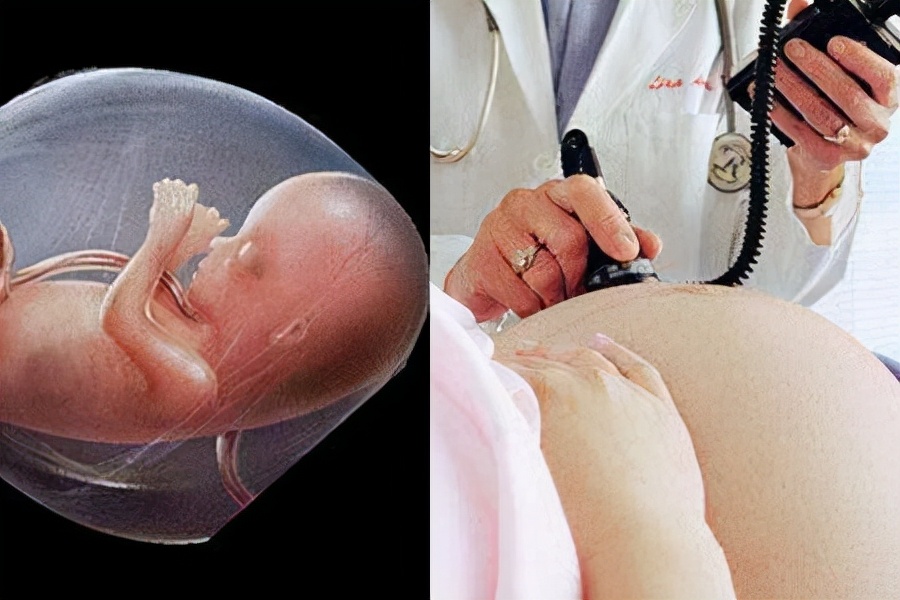 什么是胎芽、胎心？胎心又有什么意义？