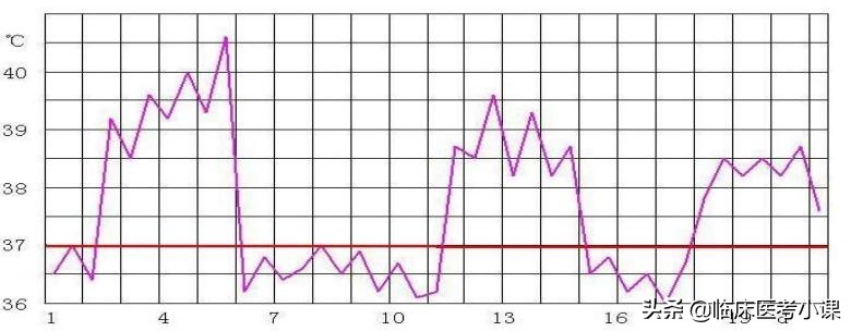 诊断学常见发热症状,诊断学发热分级