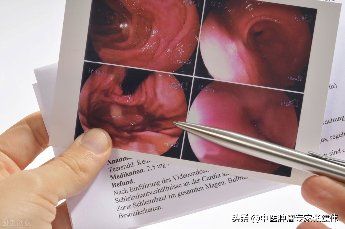 胃镜不能做还可以做什么检查,胃镜是做普通的好还是无痛胃镜好