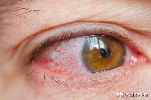 高血压人可以一直吃维生素b2吗,维生素b2对高血压有辅助作用