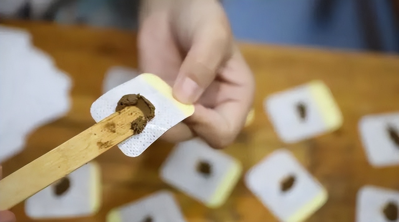 压力性尿失禁全攻略,压力性尿失禁最新指南