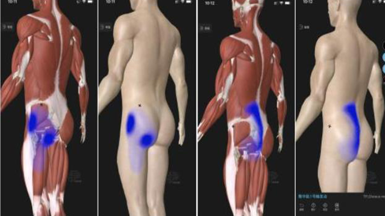 臀部疼痛和麻木怎么回事,臀部疼痛的原因及解决方法