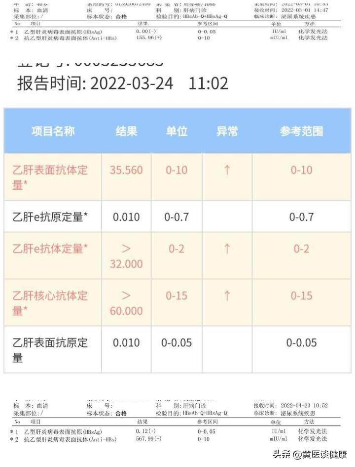 联合免疫治疗新策略,联合治疗乙肝表面抗原转阴概率