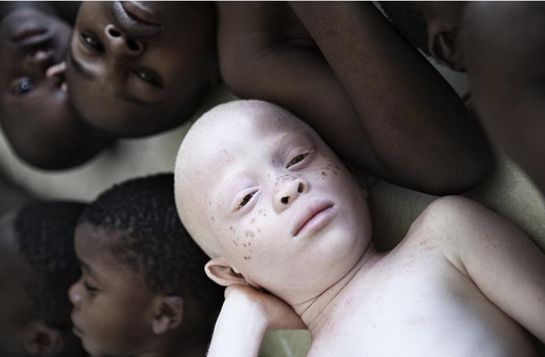 非洲版唐僧：血液堪比钻石，躯干价值126万元，警方24小时守卫