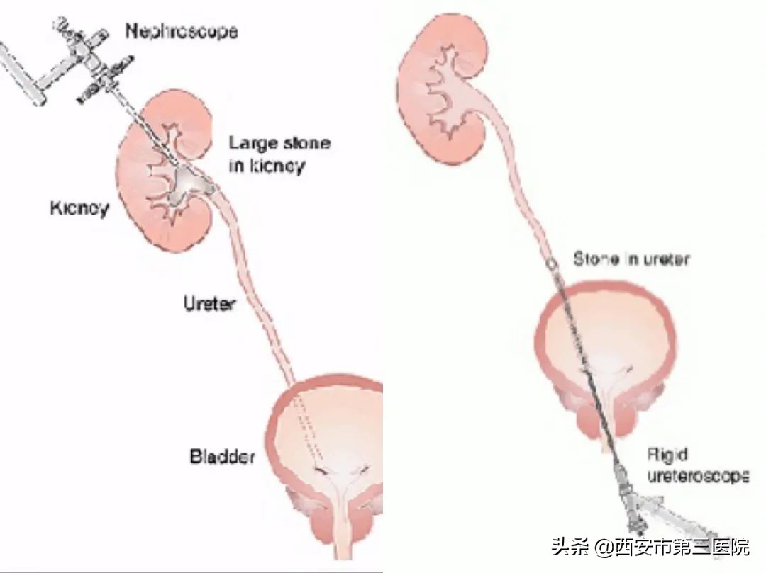 高温红色预警暴雨预警,高温红色预警和暴雨蓝色预警四川