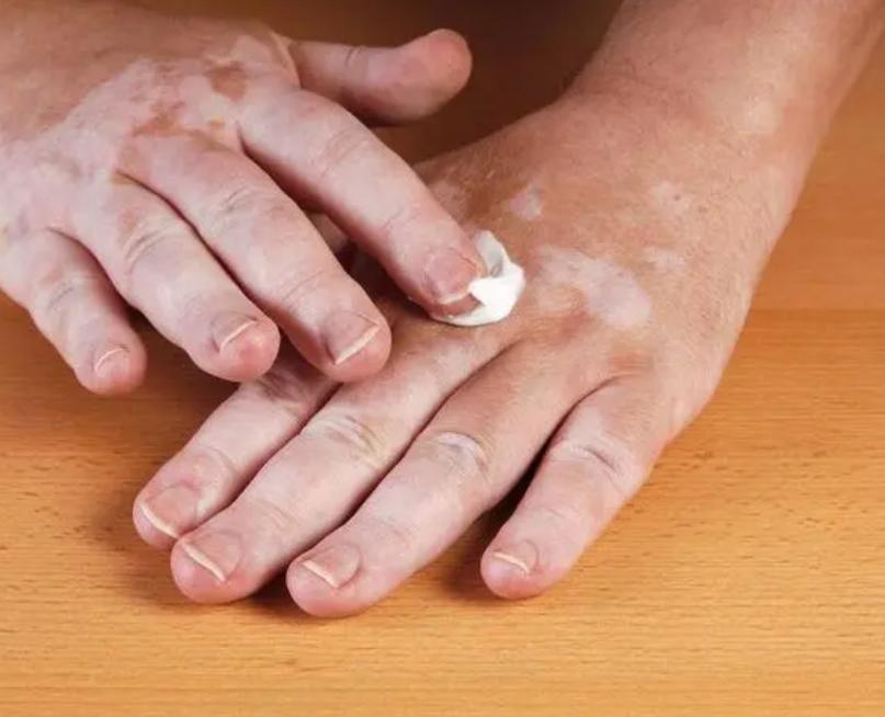 阴毛有何作用？要刮掉吗？从黑变白表示着什么？不要羞于了解