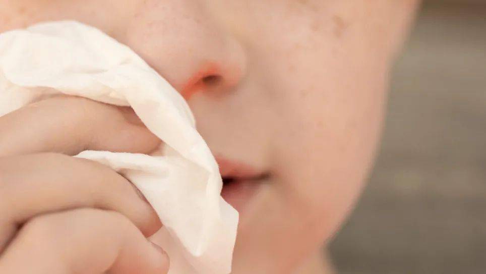 冬天鼻腔干燥，涂抹橄榄油、香油就能够缓解吗？特别不适合这类人