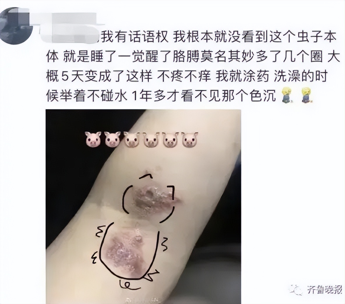 “我的脸被它毁容了…”毒液堪比硫酸！西安也有！