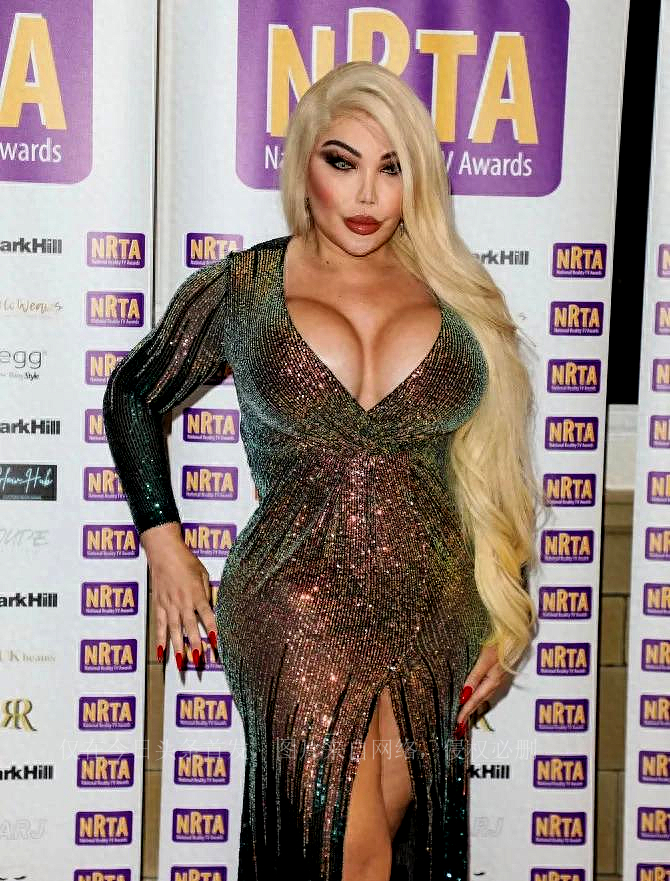 “真人肯尼”痴迷整容。多年后，最终将自己整成了女人