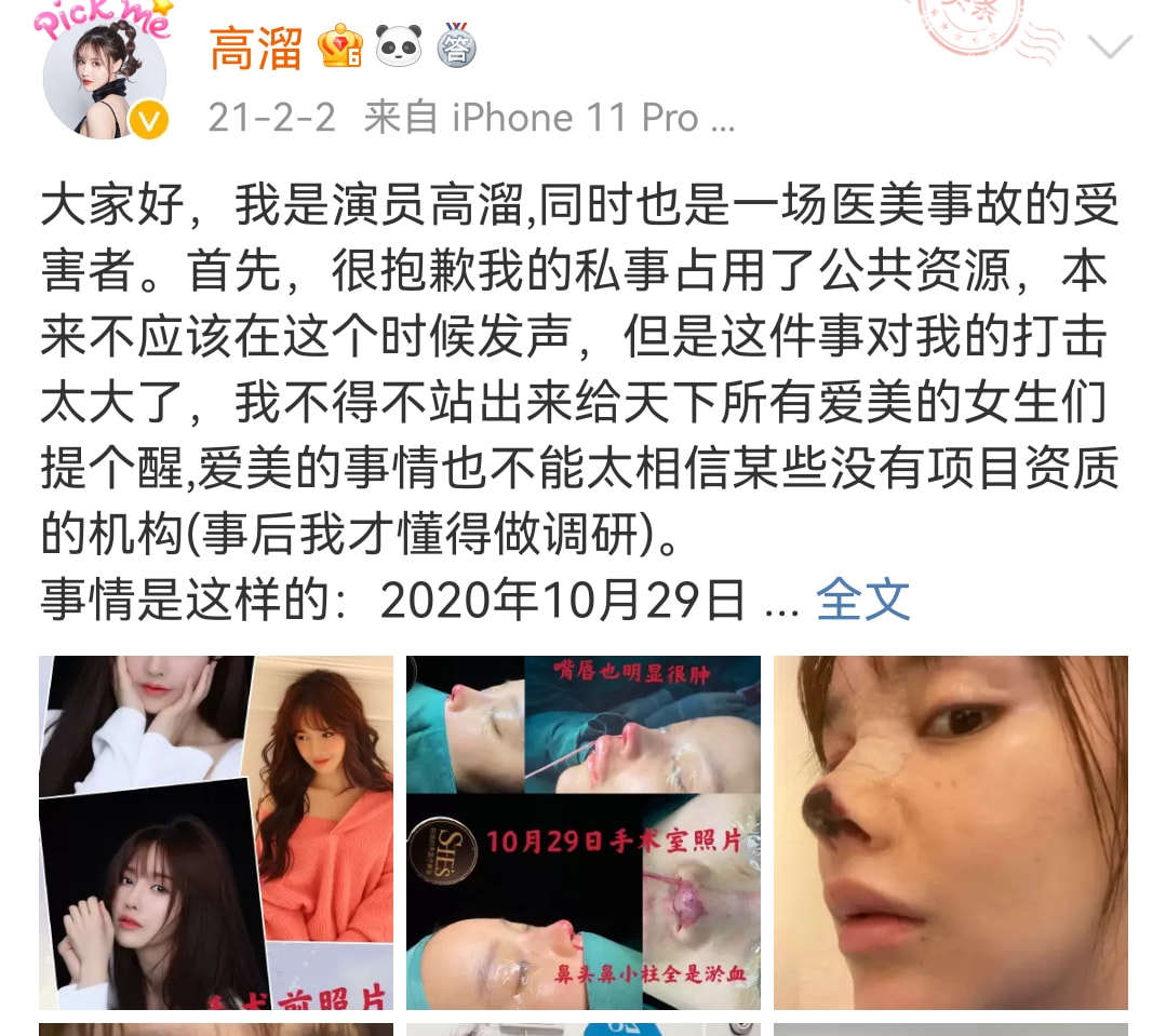 喝利尿剂，洗肠瘦小腹，整骨十次，女明星为了变美简直不要太狠