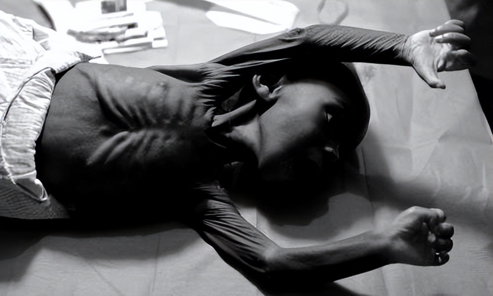 2013年，非洲2岁“巫童”遭父母遗弃，饿得皮包骨，如今还活着吗