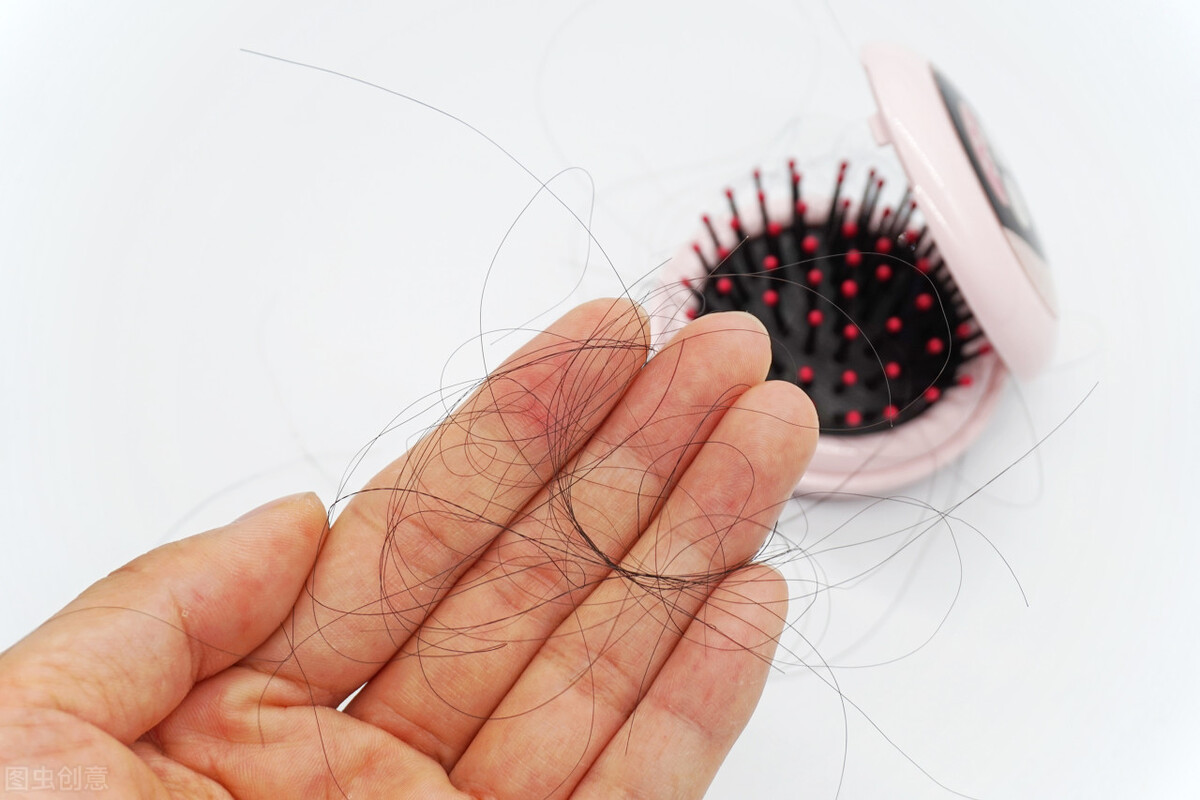 脱发严重应该多洗头还是少洗头,长时间不洗头导致的脱发怎么改善