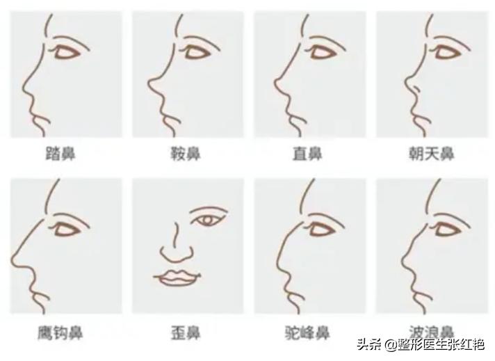 鼻子整形变美视频,鼻子整容成功明星