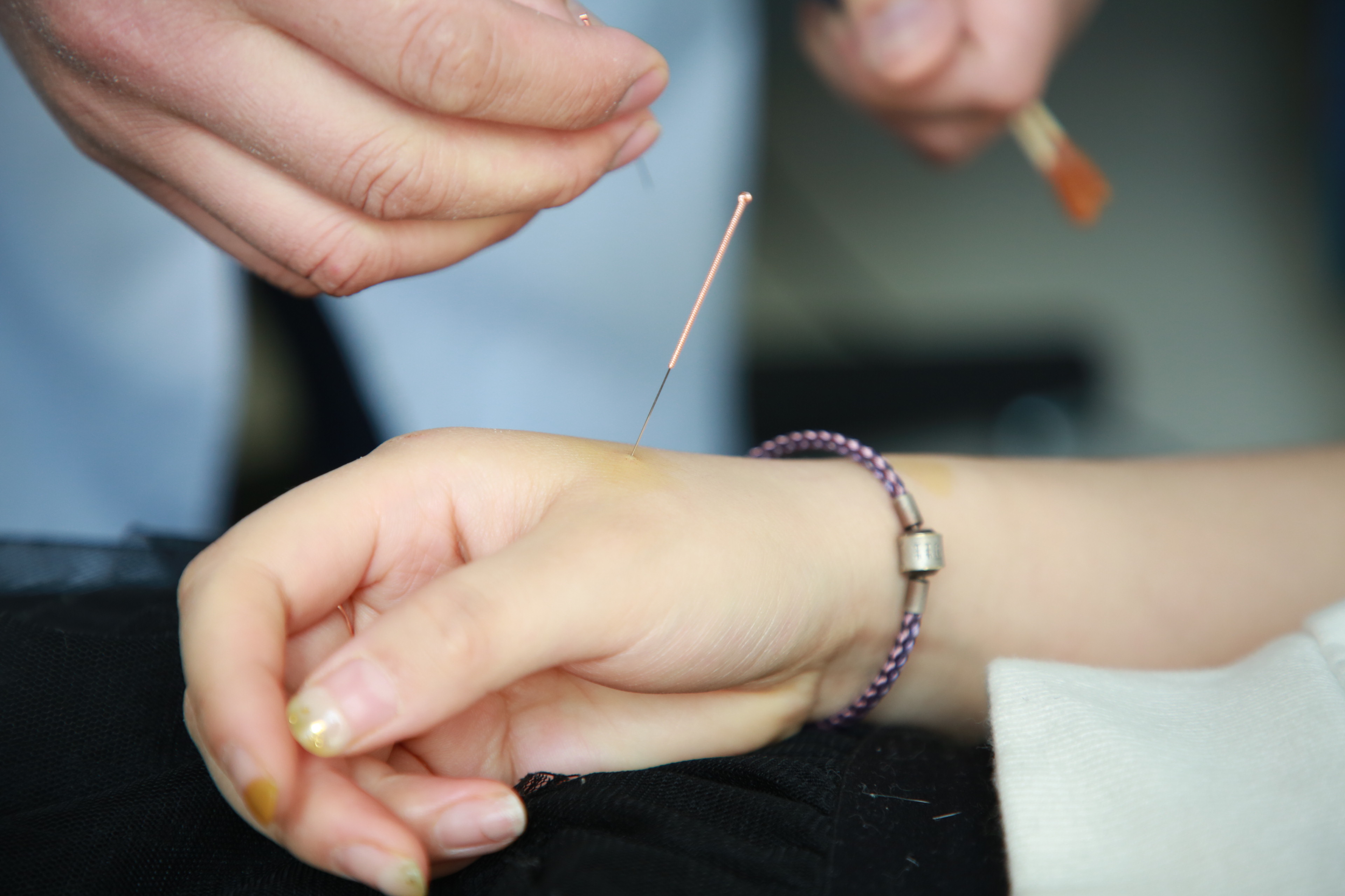 产后肩膀受凉用艾灸还是针灸好,产后怕冷怎么调理