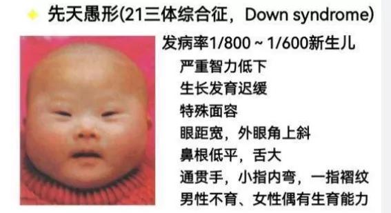 为了逼中国人接受“眯眯眼”是美，一大波洗地文来了，角度真刁钻