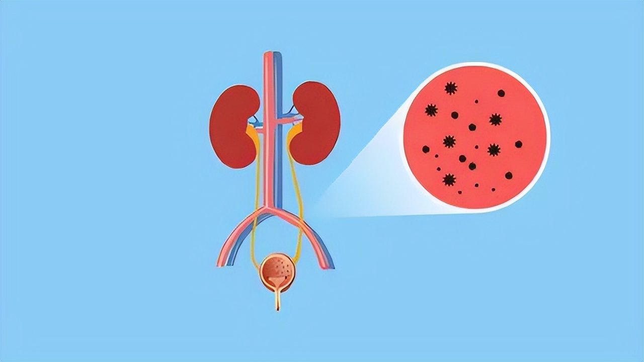 得了尿道炎会有哪些症状,尿道炎和膀胱炎的症状有什么区别