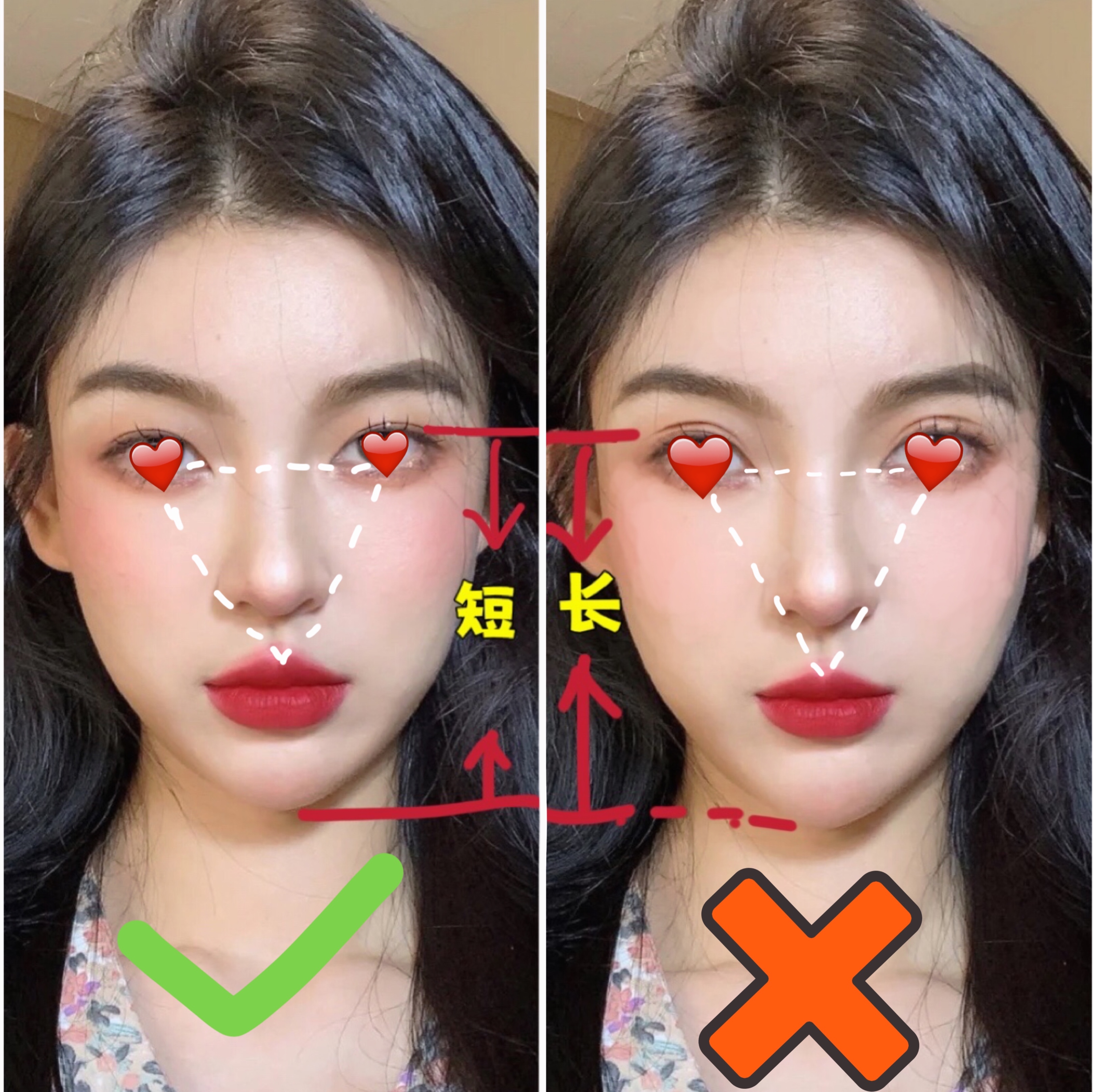 整形科普知识修复双眼皮,双眼皮整形有哪些常见方法