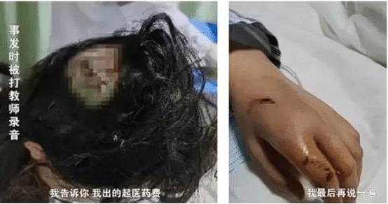 女钢琴老师被打,女钢琴老师被打后续